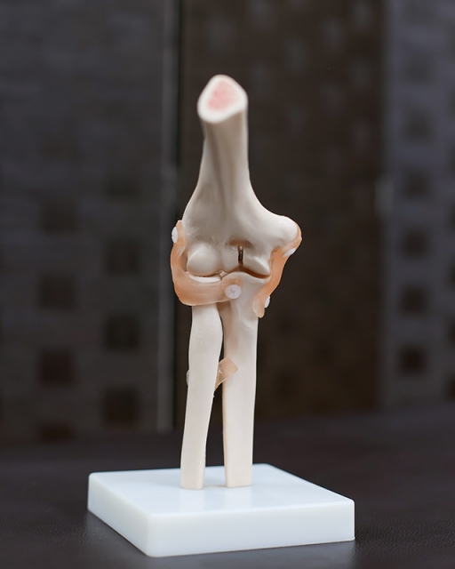 肘の骨折　ひじの痛み　さいたま市　整骨院