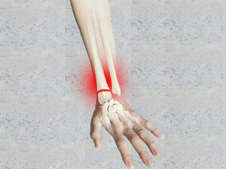 手首の痛み　病院