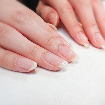 さいたま市　指の変形　治療　接骨院